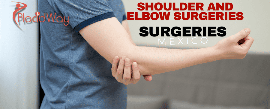 Shoulder and Elbow Surgeries in Mexico: Affordable and Quick Solutions for Canadians
