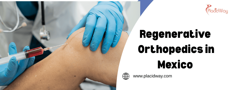 Regenerative Orthopedics in Mexico