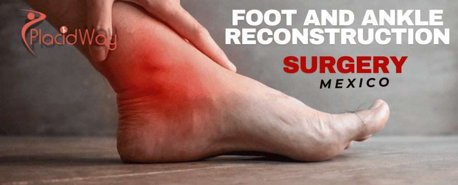 Foot and Ankle Reconstruction in Mexico: An Ideal Solution for Canadians Seeking Quick Relief
