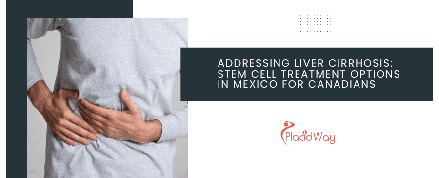 Addressing Liver Cirrhosis: Stem Cell Treatment Options in Mexico for Canadians