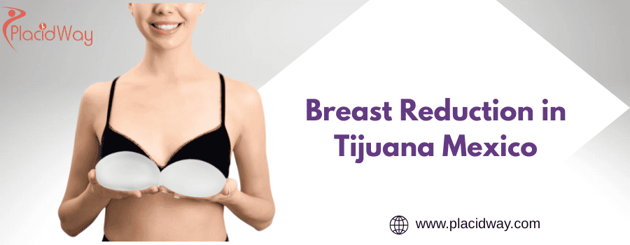 Breast Reduction in Tijuana Mexico