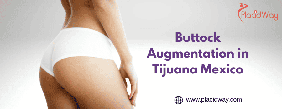 Buttock Augmentation Cost in Tijuana Mexico