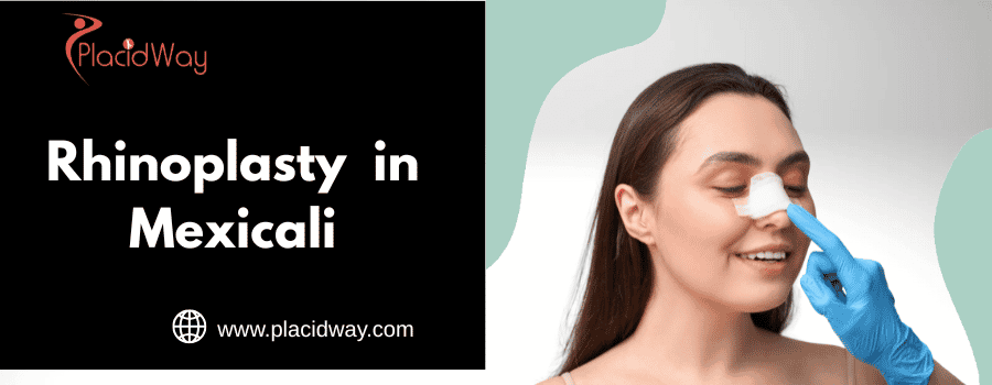 Rhinoplasty  in Mexicali