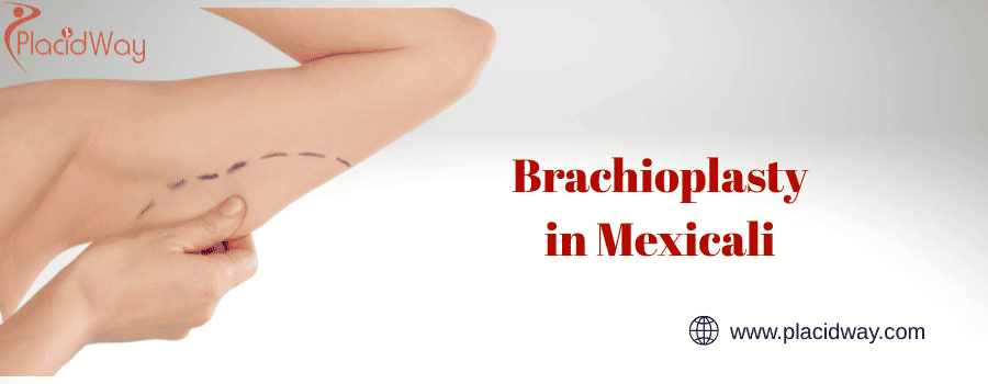 Brachioplasty in Mexicali