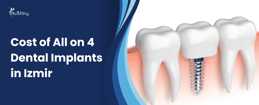 Cost of All on 4 Dental Implants in Izmir