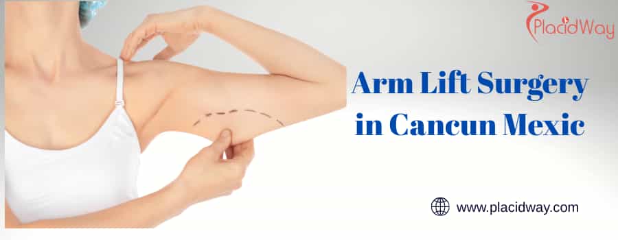 Arm Lift Surgery Price in Cancun Mexic