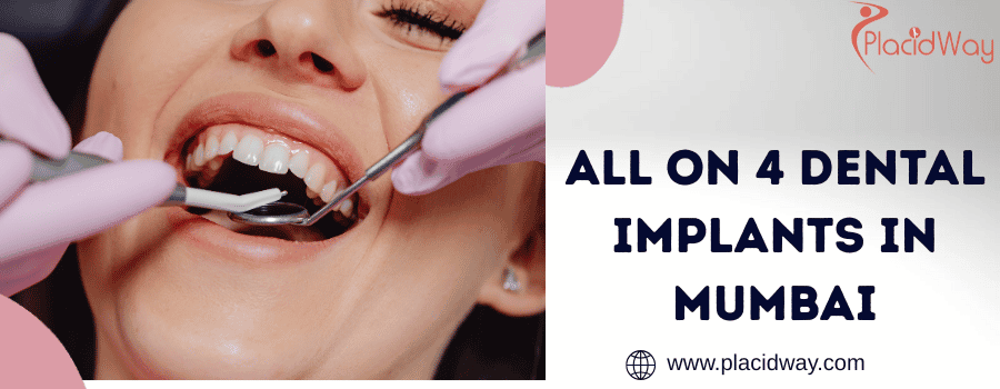 Cost for All on 4 Dental Implants in Mumba