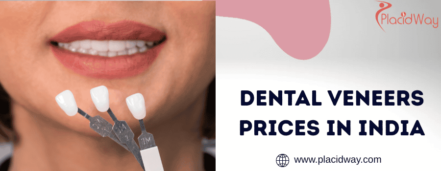 Dental Veneers Prices in India