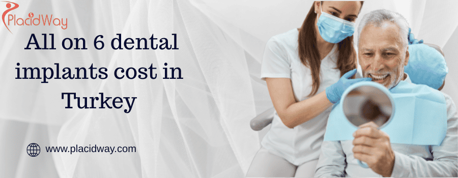  All on 6 dental implants cost in Turkey