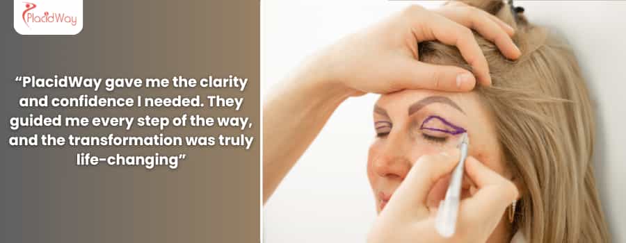 Sonja’s Journey to Confidence: A Transformative Face Lift and Eyelid Surgery in Seoul