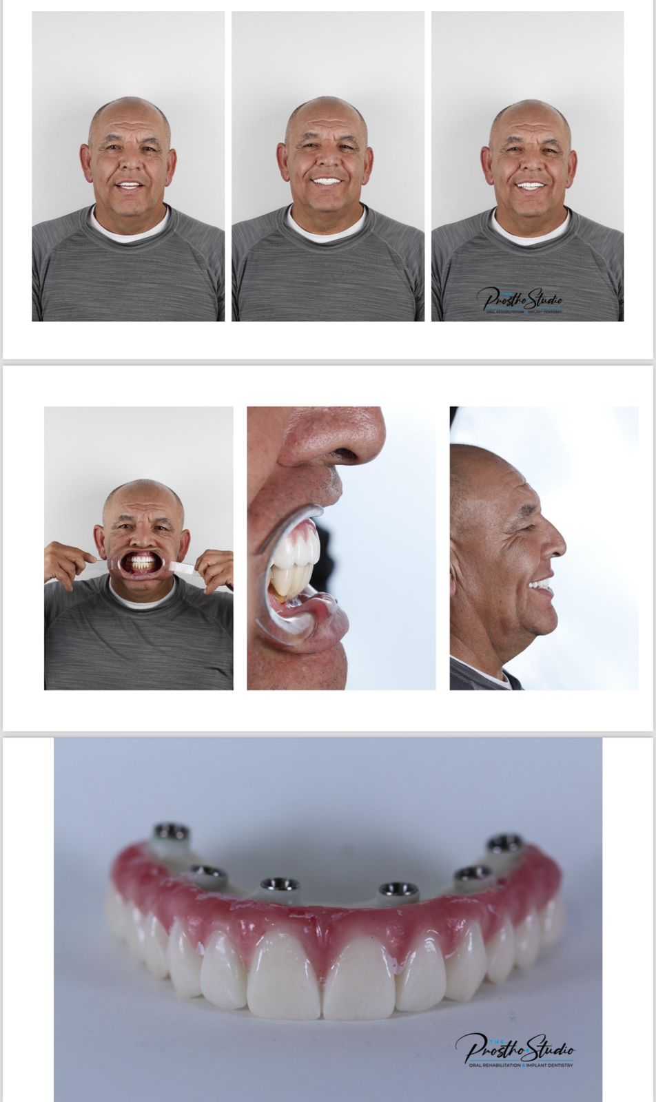 The Prostho Studio Testimonial