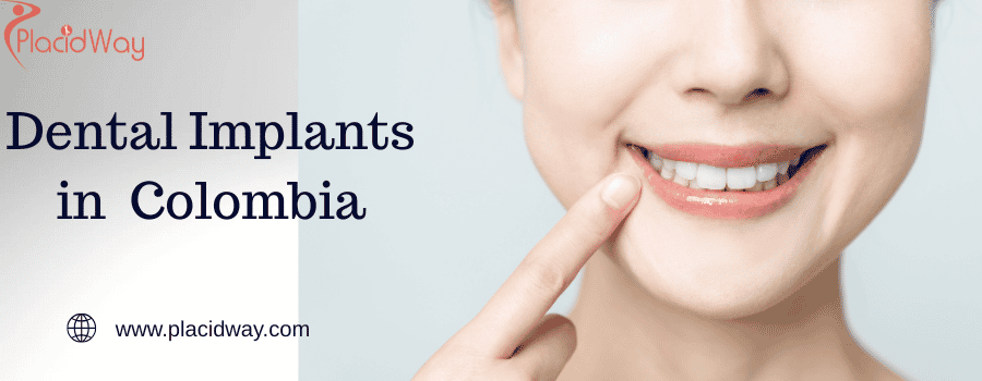 Dental Implants in  Colombia
