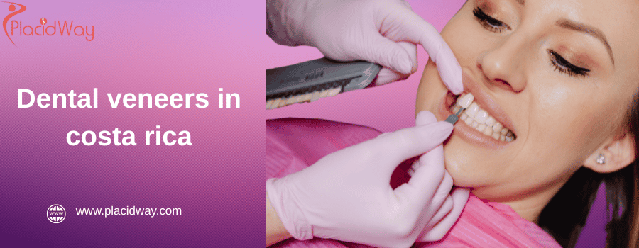 Dental veneers in costa rica