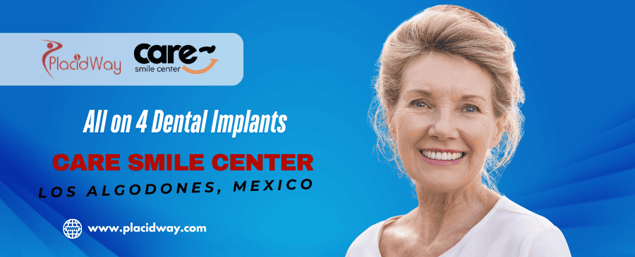 All on 4 Dental Implants in Los Algodones Package by Care Smile Center