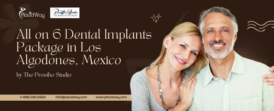 Dental Implants Los Algodones: All on 6 Package by The Prostho Studio in Mexico