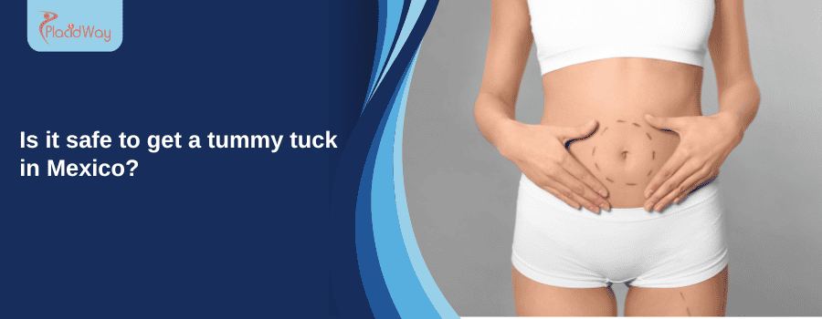 Tummy Tuck in Mexico