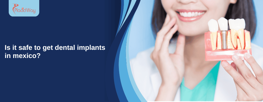 Dental implants in Mexico