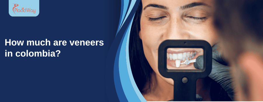 Dental veneers in Colombia