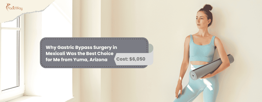 Gastric Bypass Surgery in Mexicali