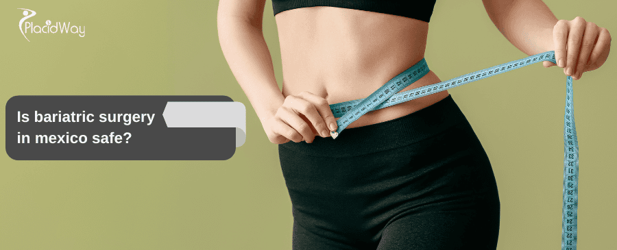 Bariatric surgery in Mexico