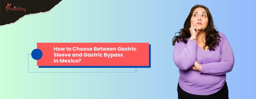 How to Choose Between Gastric Sleeve and Gastric Bypass in Mexico?