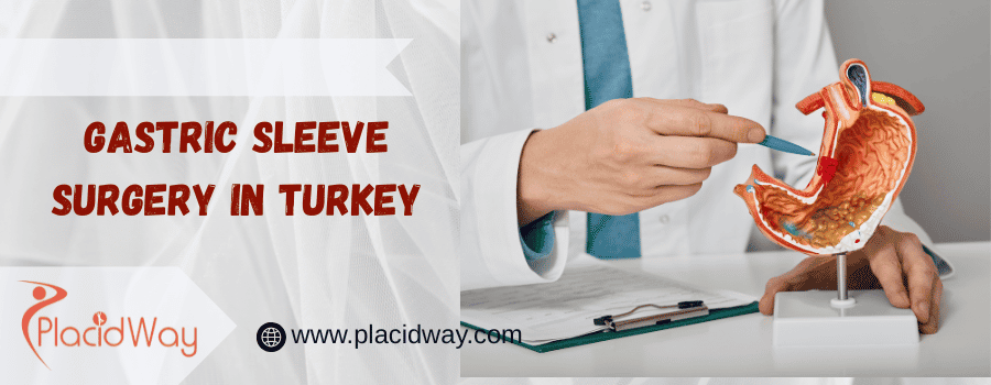 gastric sleeve surgery in Turkey