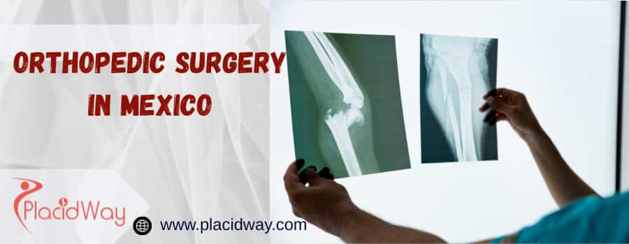 orthopedic surgery in Mexico
