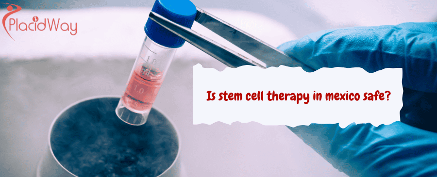 stem cell therapy in mexico safe