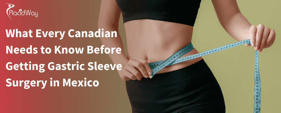 Canadian Needs to Know Before Getting Gastric Sleeve Surgery in Mexico 