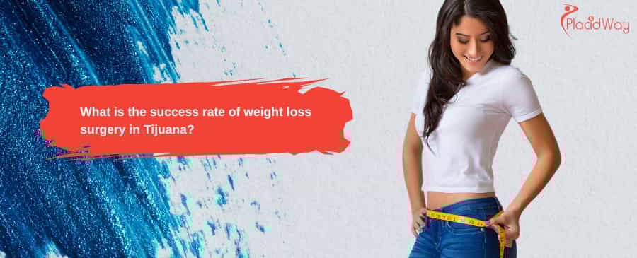 weight loss surgery in Tijuana