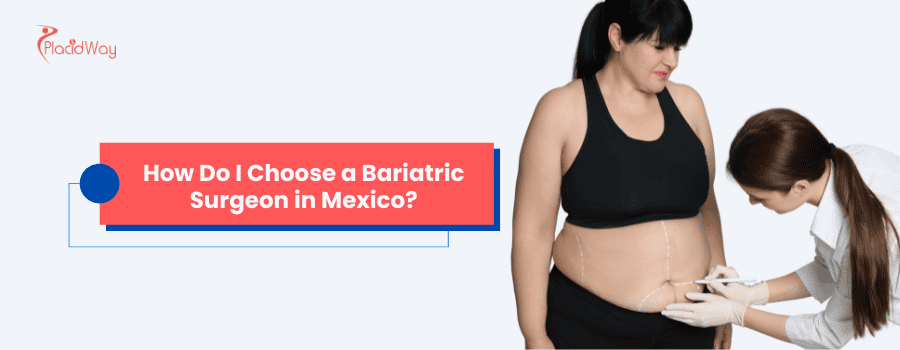 How Do I Choose a Bariatric Surgeon in Mexico?