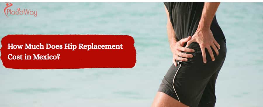 Hip Replacement Cost in Mexico