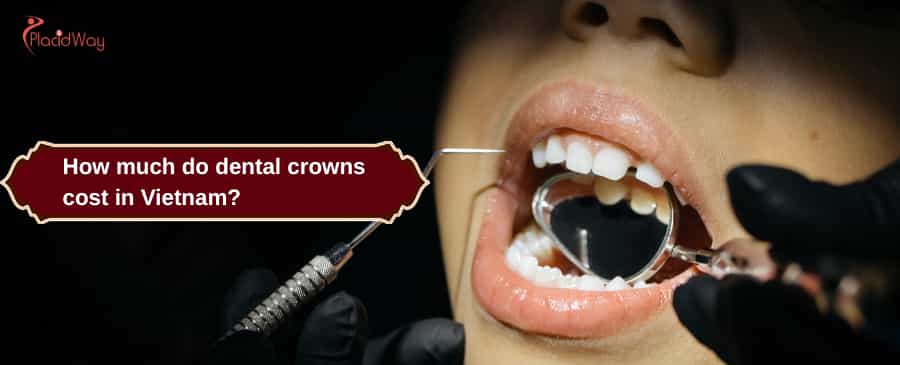 dental crowns cost in Vietnam