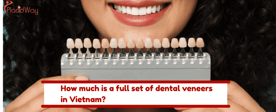 full set of dental veneers in Vietnam