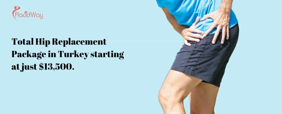 Total Hip Replacement Package In Turkey Starting At Just $,.