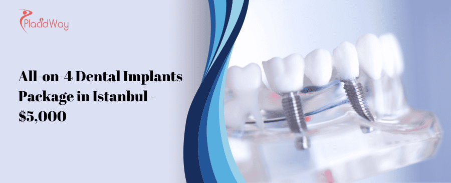 All On  Dental Implants Package In Istanbul   $,