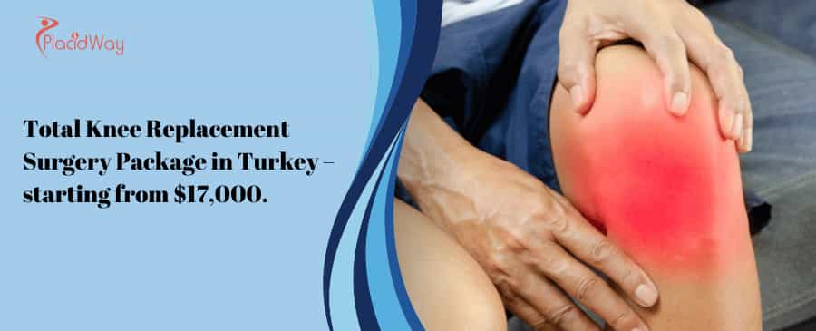 Total Knee Replacement Surgery Package In Turkey – Starting From $,.