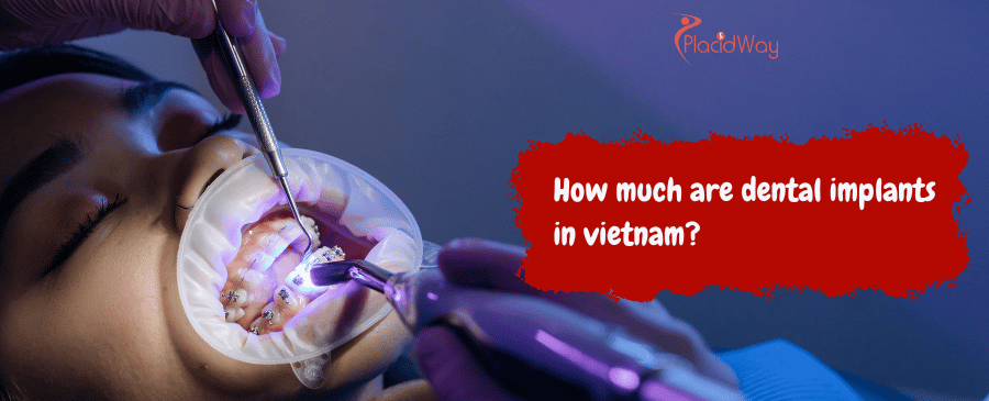 dental implants in vietnam