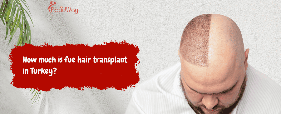 fue hair transplant in Turkey