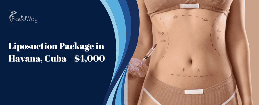 Liposuction Package In Havana, Cuba – $,