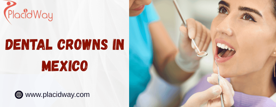 Dental Crowns In Mexico