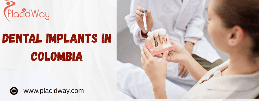 Dental Implants In Colombia