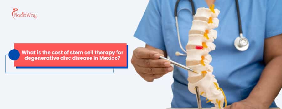 Stem Cell Therapy for Degenerative Disc Disease in Mexico
