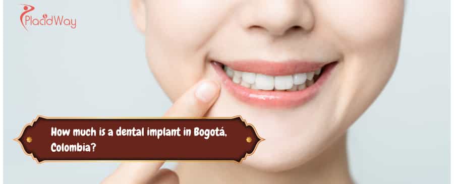 implantes dentales en Bogotá, Colombia