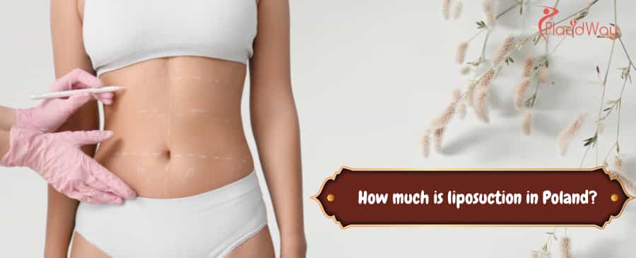 liposuction in poland