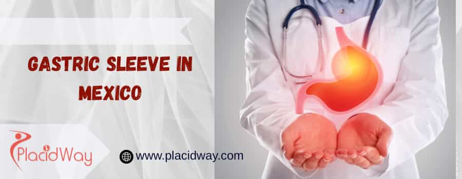 Gastric Sleeve In Mexico