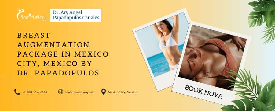 Breast Augmentation Mexico City – $6,000 by Dr. Papadopulos