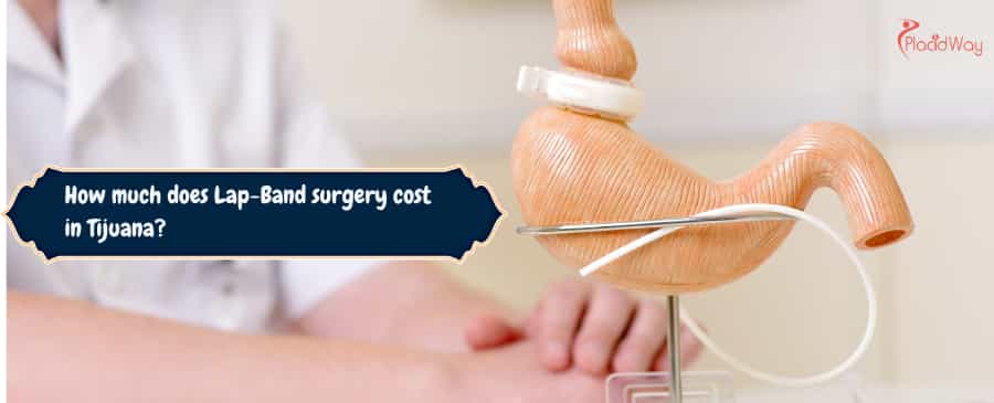 Lap band surgery in Tijuana