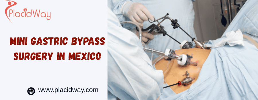 mini gastric bypass surgery in mexico