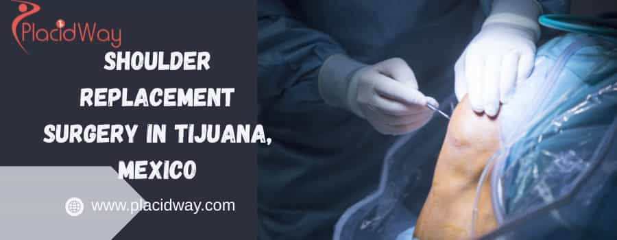 shoulder replacement surgery in Tijuana, Mexico